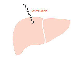Graphic showing DAWNZERA™ is specifically targeted to the liver in Step 1.